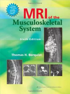 MRI of the Musculoskeletal System