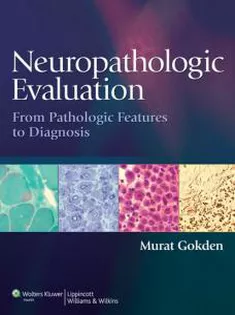 Neuropathologic Evaluation: From Pathologic Features to Diagnosis