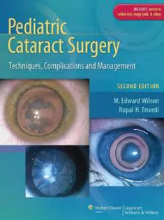 Pediatric Cataract Surgery