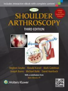 Shoulder Arthroscopy