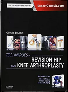 Techniques in Revision Hip and Knee Arthroplasty