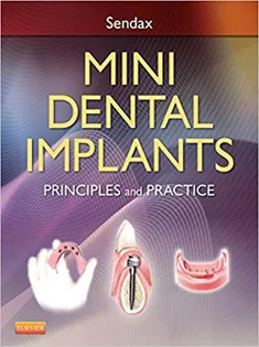 Mini Dental Implants