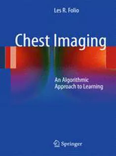 Chest Imaging :An Algorithmic Approach to Learning