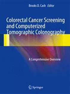 Colorectal Cancer Screening and Computerized Tomographic Colonography