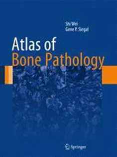 9781461463269 Atlas of Bone Pathology