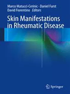 Skin Manifestations in Rheumatic Disease
