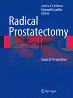 9781461486923 Radical Prostatectomy: Surgical Perspectives