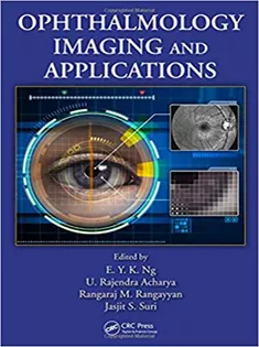 Ophthalmological Imaging and Applications