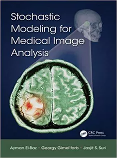 Stochastic Modeling for Medical Image Analysis