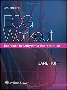 ECG Workout: Exercises in Arrhythmia Interpretation