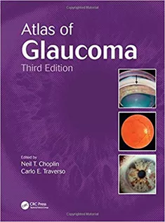 Atlas of Glaucoma