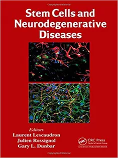 Stem Cells and Neurodegenerative Diseases