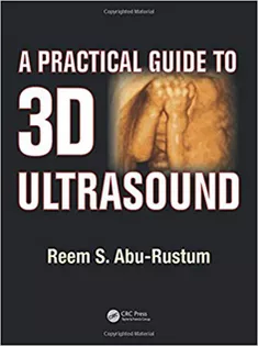 A Practical Guide to 3D Ultrasound