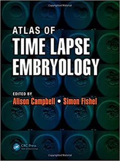 Atlas of Time Lapse Embryology