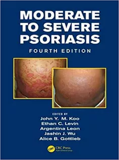 Moderate to Severe Psoriasis