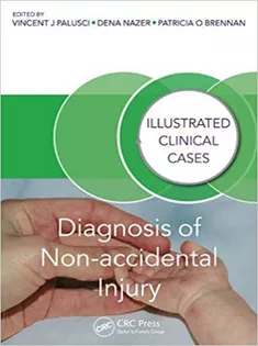 Diagnosis of Non-accidental Injury: Illustrated Clinical Cases