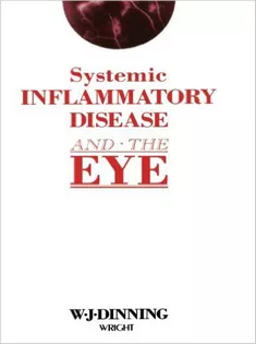 Systemic Inflammatory Disease and the Eye