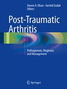 9781489976055 Post-Traumatic Arthritis: Pathogenesis, Diagnosis and Management