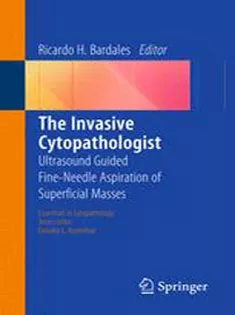 The Invasive Cytopathologist: Ultrasound Guided Fine-Needle Aspiration of Superficial Masses