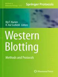 Western Blotting: Methods and Protocols