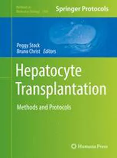 Hepatocyte Transplantation: Methods and Protocols