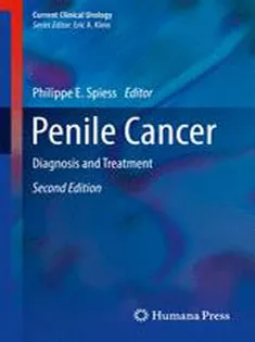 Penile Cancer: Diagnosis and Treatment