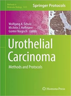 Urothelial Carcinoma: Methods and Protocols
