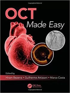 9781498714563 OCT Made Easy