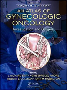 An Atlas of Gynecologic Oncology: Investigation and Surgery