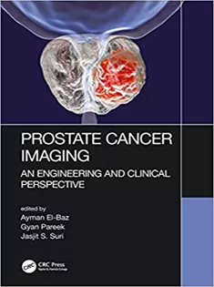 Prostate Cancer Imaging: An Engineering and Clinical Perspective