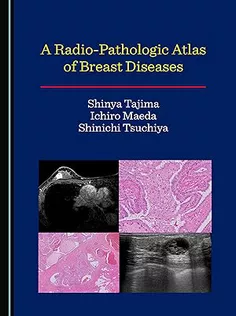 A Radio-Pathologic Atlas of Breast Diseases