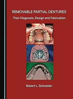 Removable Partial Dentures