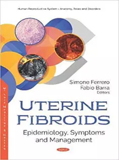 Uterine Fibroids: Epidemiology, Symptoms and Management