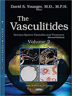 The Vasculitides: Nervous System Vasculitis and Treatment
