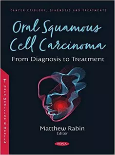 Oral Squamous Cell Carcinoma: From Diagnosis to Treatment