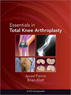 Essentials in Total Knee Arthroplasty