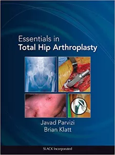 9781556428708 Essentials in Total Hip Arthroplasty