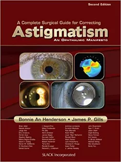 A Complete Surgical Guide for Correcting Astigmatism