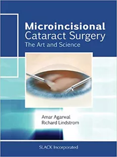 9781556429439 Microincisional Cataract Surgery: The Art and Science