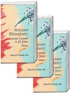 Structure rhinoplasty : lessons learned in 30 years