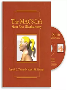 The Macs-lift Short Scar Rhytidectomy