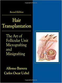 Hair Transplantation: The Art of Micrografting and Minigrafting