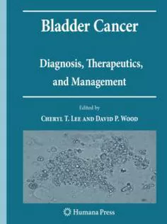 Bladder Cancer Diagnosis, Therapeutics, & Management