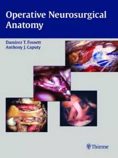 Operative Neurosurgical Anatomy