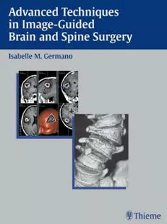 Advanced Techniques in Image-Guided Brain and Spine Surgery