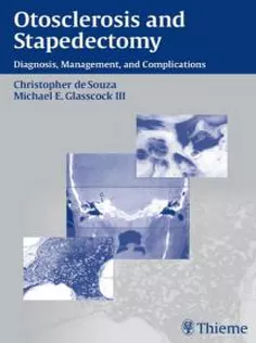 Otosclerosis and Stapedectomy