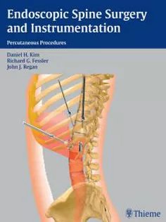 Endoscopic Spine Surgery and Instrumentation