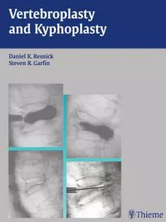 Vertebroplasty and Kyphoplasty