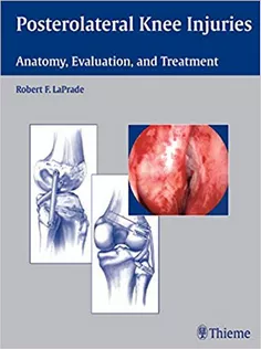 Posterolateral Knee Injuries