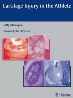 Cartilage Injury in the Athlete